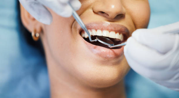 Best Emergency Dental Care for Abscessed Tooth in Frisco, TX